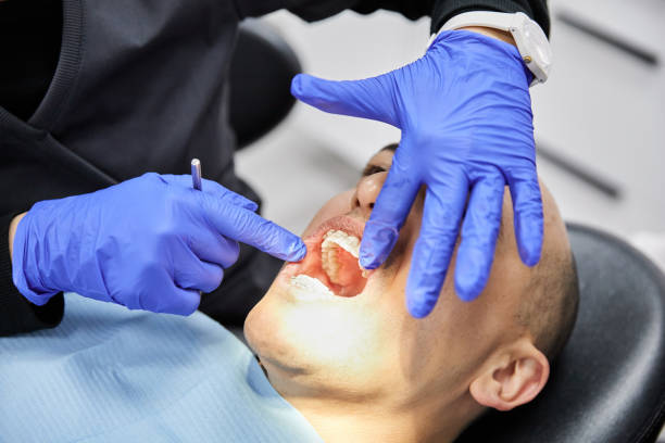 Best Emergency Root Canal Treatment in Fort Washington, MD